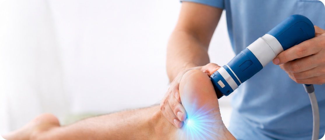Shockwave therapy for plantar fasciitis